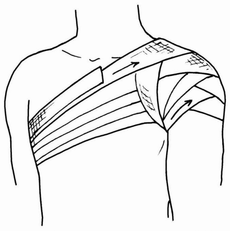 Как замотать плечо эластичным бинтом самому схема